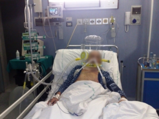 Ventilazione non Invasiva (NIV) CPAP in Terapia Intensiva
