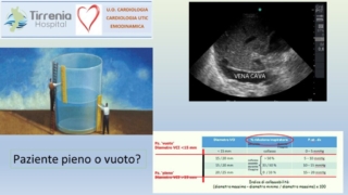 Diapositiva28